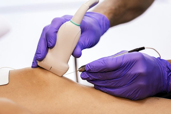 Découvrez nos epi de haute qualité abordables